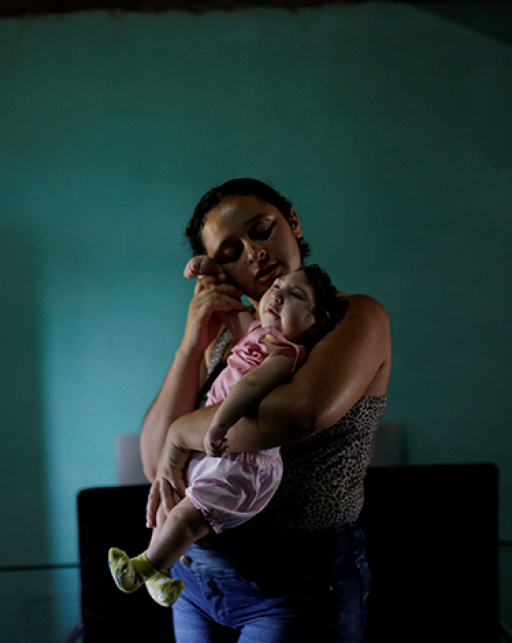 a mother holds a baby with microcephaly, Brazil